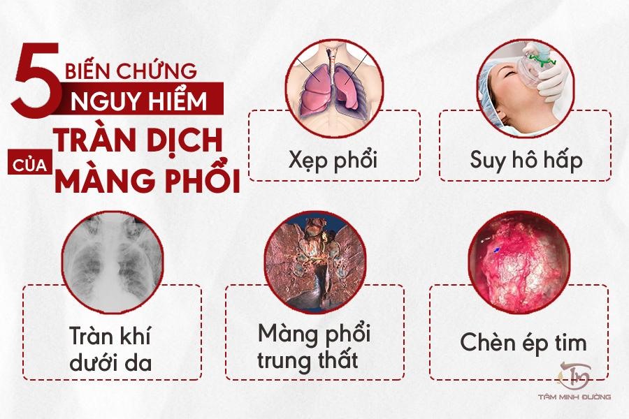 Phòng ngừa tràn dịch màng phổi cho người cao tuổi